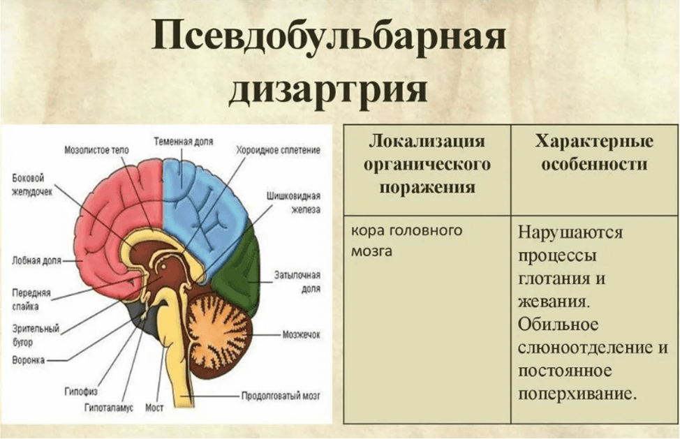Изображение по разделу: Формы псевдобульбарной дизартрии