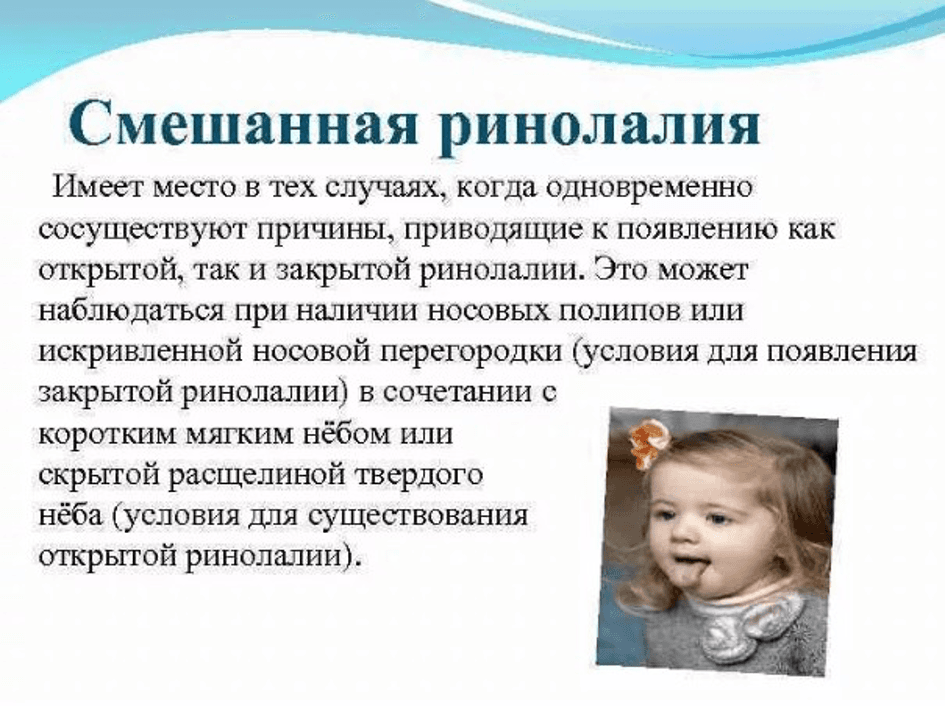Изображение по разделу: Характерные особенности ринолалии