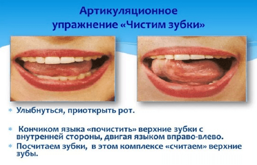 Изображение по разделу: Можно ли и как избавиться от картавости