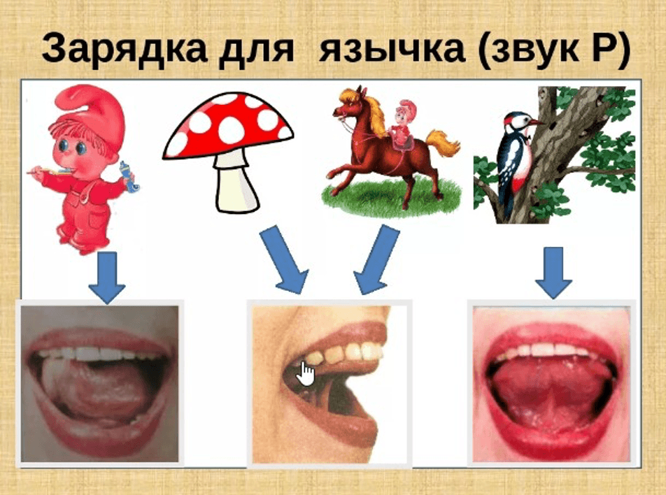 Изображение по разделу: Нарушения произношения звуков [Л], [Л’], [Р], [Р’]