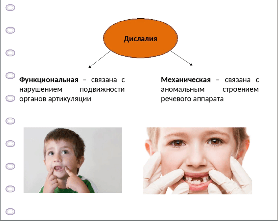 Изображение по разделу: Основная классификация дислалии