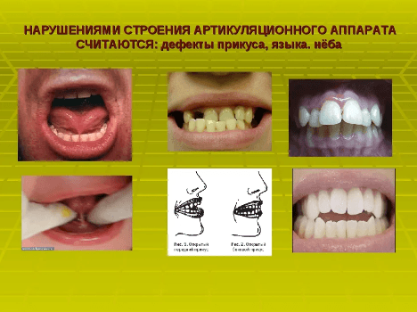 Изображение по разделу: Основные дефекты