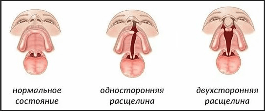 Изображение по разделу: Основные симптомы