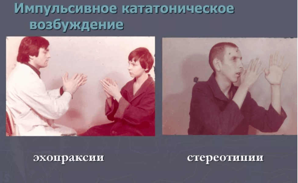 Изображение по разделу: Особенности эхопраксии