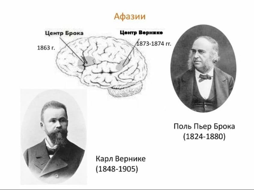 Изображение по разделу: Причины афазии