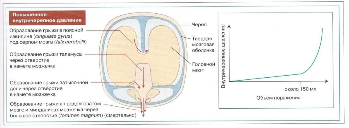 Изображение к статье: Причины возникновения нарушений речи