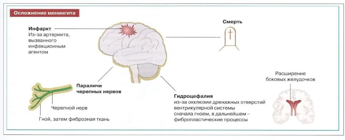 Изображение к статье: Причины возникновения нарушений речи