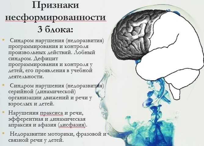 Изображение к статье: Просто о сложном: нейропсихология