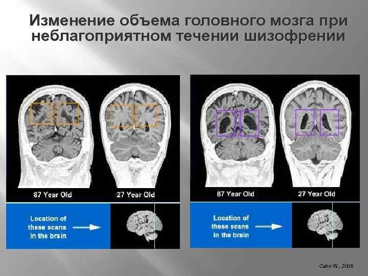 Изображение к статье: Психиатрия или неврология? Специфика диагноза "аутизм"