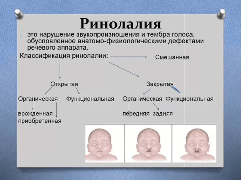 Изображение к статье: Ринолалия