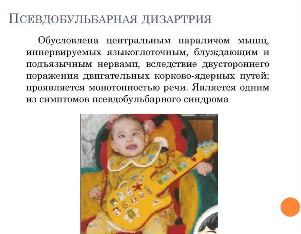 Изображение по разделу: Симптомы псевдобульбарной дизартрии