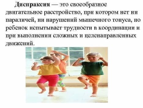 Изображение по разделу: Виды диспраксии