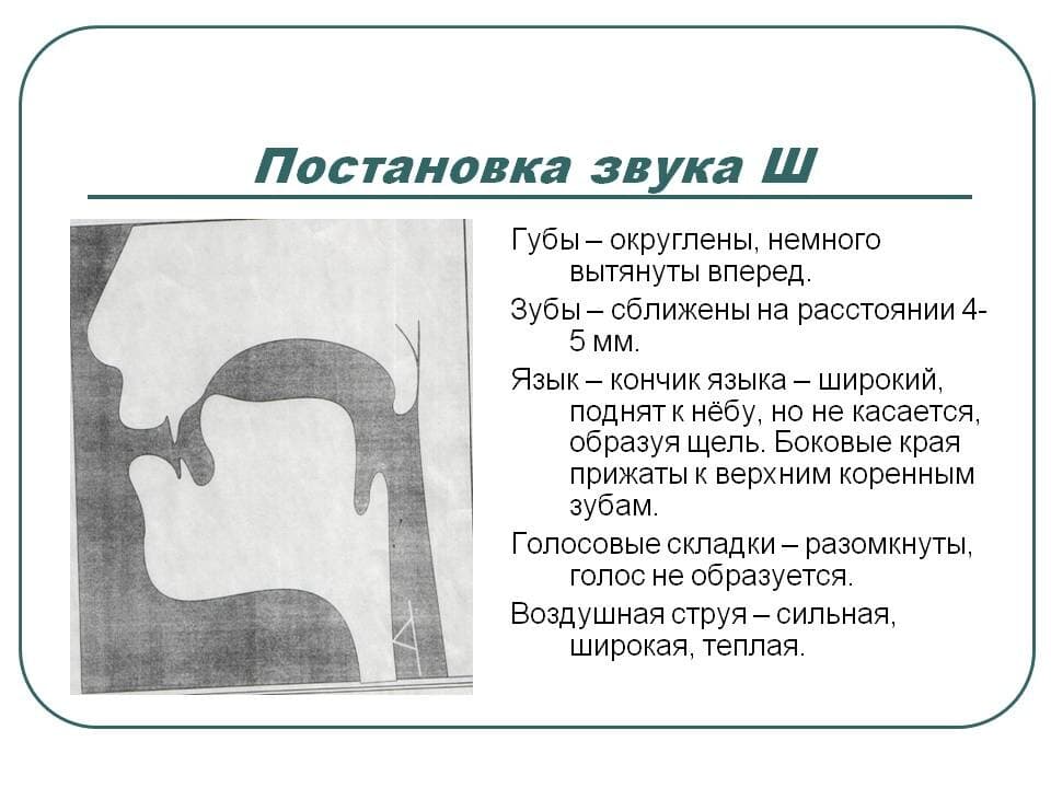 Изображение по разделу: Виды нарушений произношения звука Ш